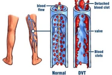 A diagram of blood flow and vein formation.
