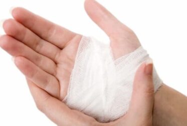 Burns first aid with gauze bandage wrapped neatly around injured hand